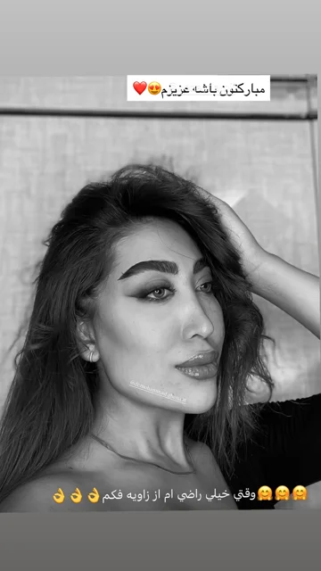 رضایت زیباجوی مطب از زاویه فک