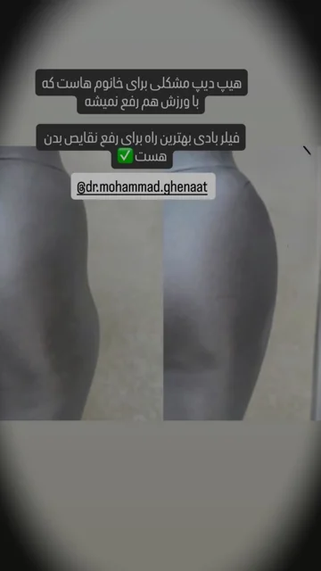 هیپ دیپ
