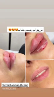 نمونه استوری
