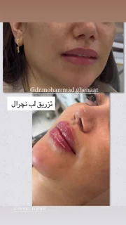 نمونه استوری