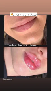 نمونه استوری